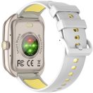 Colmi P86 okosóra AMOLED kijelzővel, pulzusméréssel, 1ATM vizállóssággal, arany