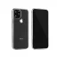 Xiaomi 17 szilikon tok, 0,5mm, ultravékony, átlátszó